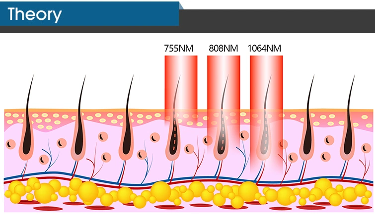 Permanent Hair Removal Laser ADSS Factory Direct Sales 808nm Diode Laser Hair Removal Lifetime Maintenance Machine