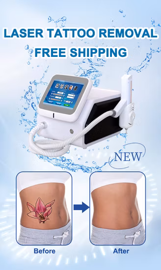 Equipamento de tratamento a laser de beleza Q Switched ND YAG Laser Pico Pigment Tattoo Removal Machine